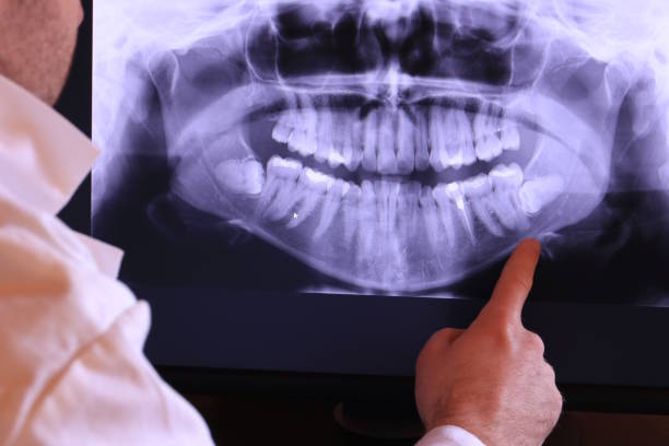 Best Emergency Care for Gum Disease in Tanaina, AK